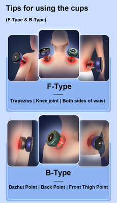 OEM/ODM Body Fitdash F-Type Cupping Cups for Customized Hijama Cupping Therapy Massager. 개인 맞춤형 히자마 컵링 치료 마사저용 피트다시 F형 컵링 컵