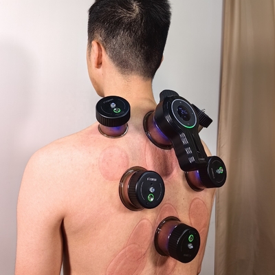 전기 진공 컵 치료 의 이점 을 우리 컵 장치 로 경험 해 보십시오