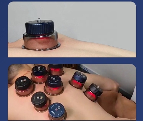 지능형 호흡 컵 -10kPa ~ 60kPa 흡수 강도 및 3.7V / 150mAh 컵
